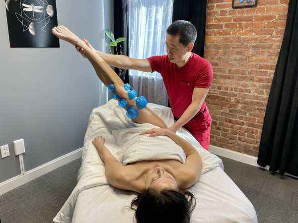 Cupping therapy technique