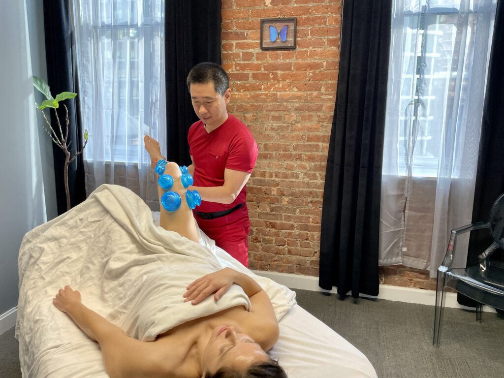 Cupping Therapy: Ancient Wisdom for Modern Healing at Body Mechanics Orthopedic Massage